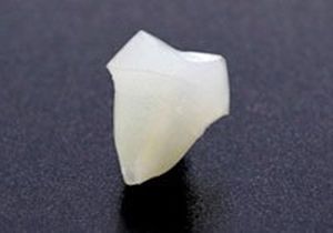 相模原市中央区横山エリア・のりデンタルクリニック・ファイバーコア