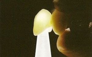 相模原市中央区横山エリア・のりデンタルクリニック・オールセラミック