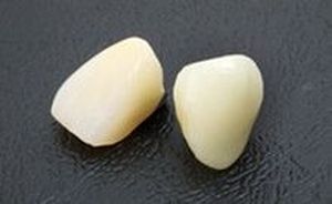 相模原市中央区横山エリア・のりデンタルクリニック・ハイブリッドセラミックス