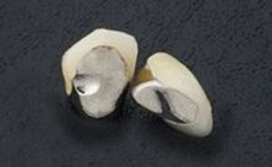 相模原市中央区横山エリア・のりデンタルクリニック・硬質レジン