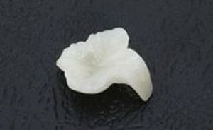 相模原市中央区横山エリア・のりデンタルクリニック・オールセラミック