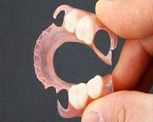 相模原市中央区横山エリア・のりデンタルクリニック・ノンクラスプ