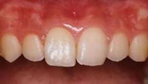 相模原市中央区横山エリア・のりデンタルクリニック・ウォーキングブリーチ